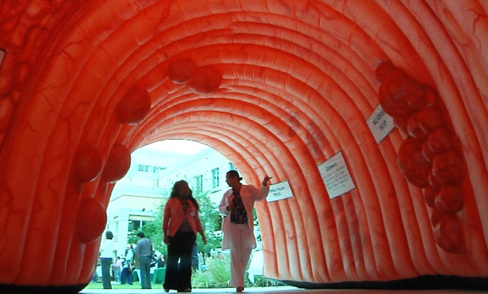 That Stolen Giant Colon Was Found How Things Worked Out In The End