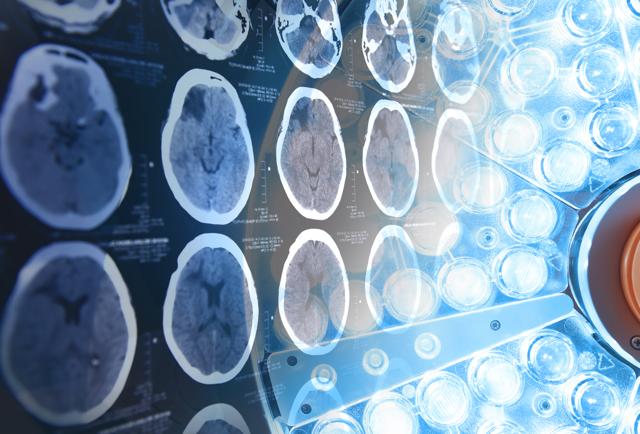 The 10 Must-Read Brain Science And Psychology Stories Of 2017