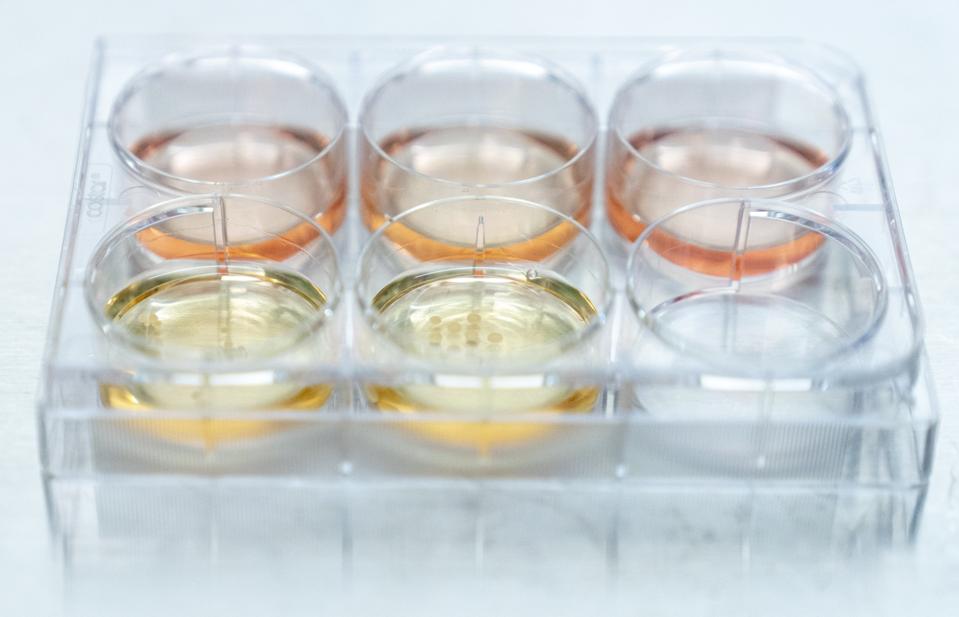 Researchers at UPenn are growing human brain organoids (sometimes called minibrains)