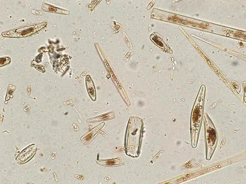 Diatoms under microscopic view