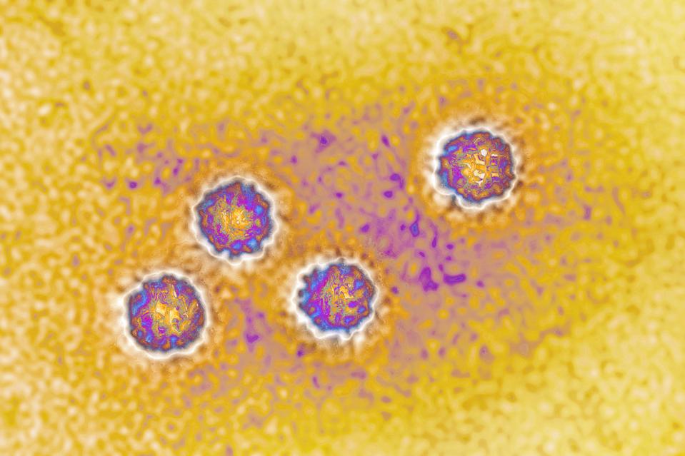 Hepatitis A virus
