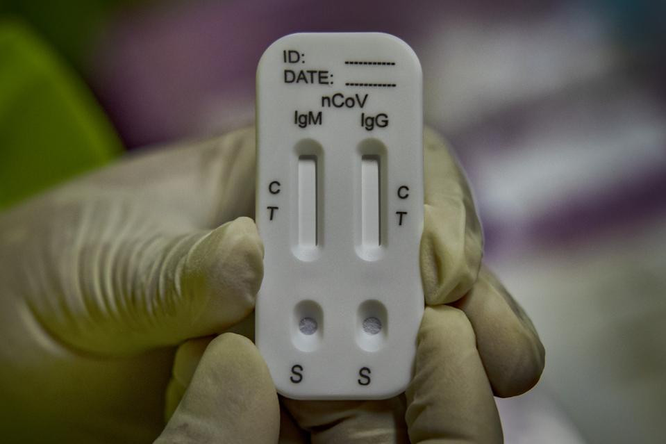 What S A Coronavirus Antibody Test