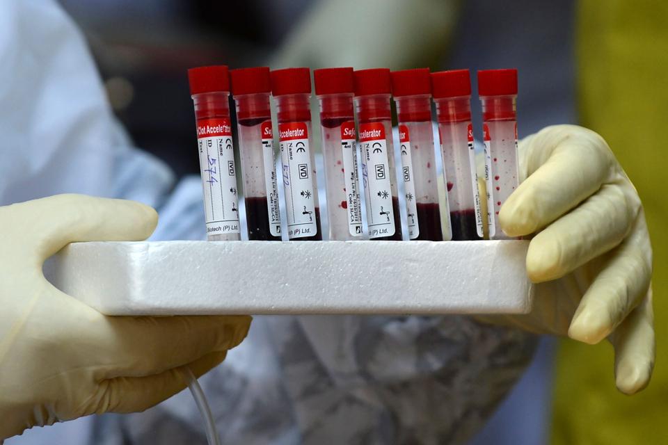 SRI LANKA-HEALTH-VIRUS