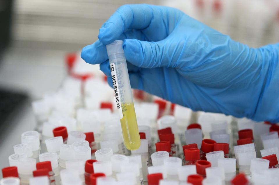 Fbi Beware Of These Covid 19 Coronavirus Antibody Testing Scams