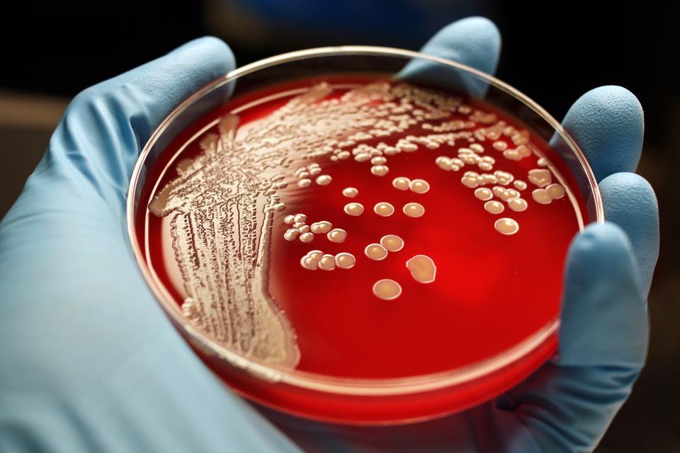 MRSA colonies on blood agar plate