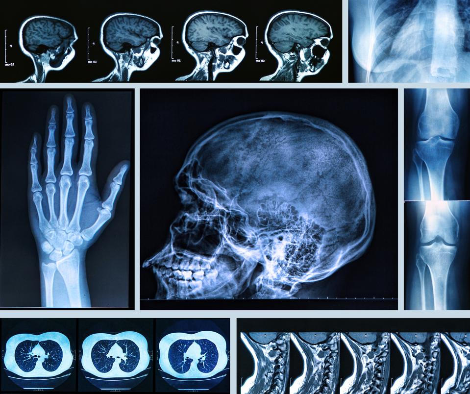 Radiography of Human Bones