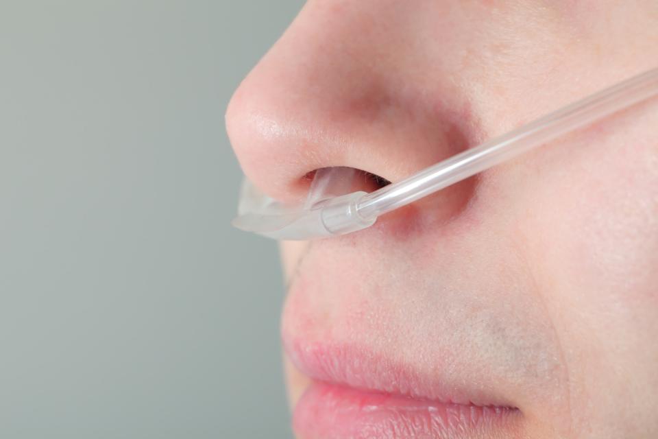 Oxygen tube with nasal prongs.