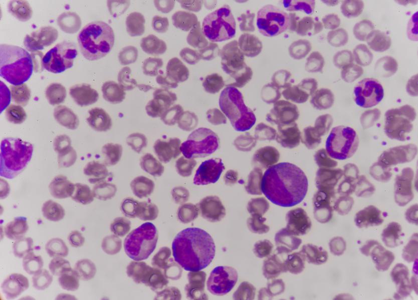 Could Breakthrough Cancer Treatments Raise Industrial Gold Demand?