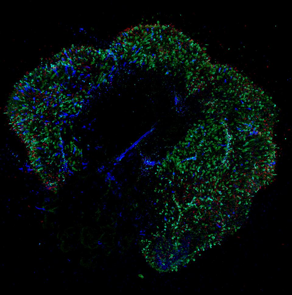 A 291-day-old retina organoid. Red and green cone photoreceptors appear green, blue cone photorectors appear blue, and rod photoreceptors appear red.