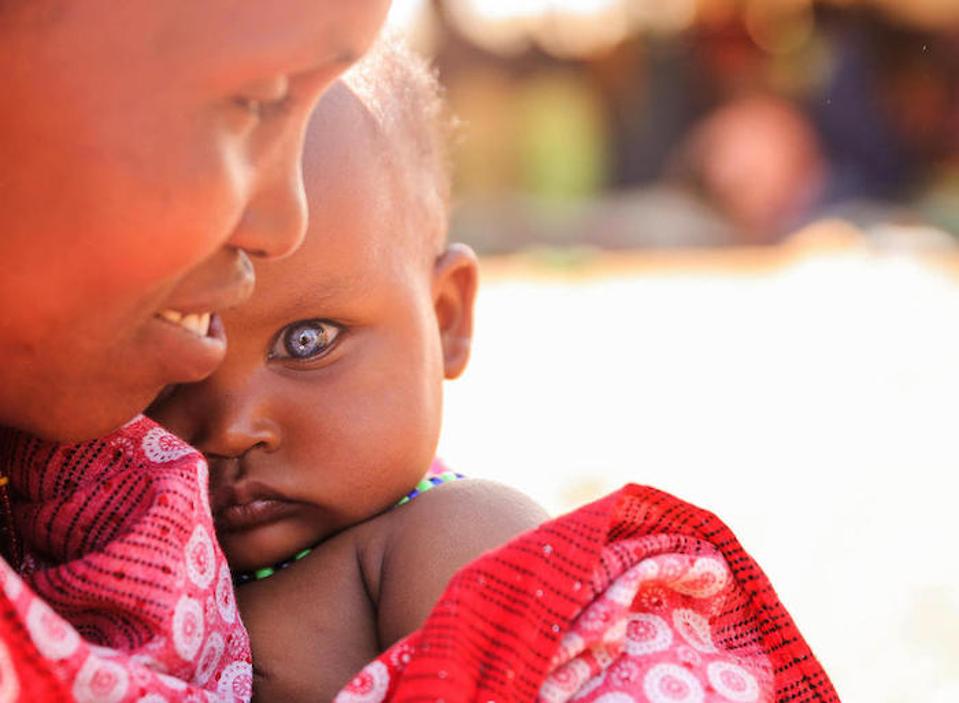 Habiba Biyow Roba, 35, madre de siete hijos, tiene a su hija de 8 meses, Sumeya, cerca de un campamento apoyado por UNICEF para personas internamente desplazadas en la región de Oromia, en Etiopía.