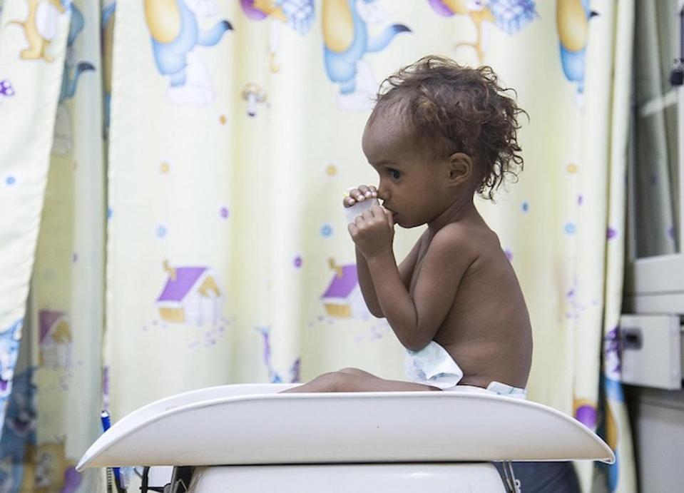 Little Saba trpel akútnou podvýživou, horúčkou a hnačkou, keď ju matka priviedla do UNICEF-podporovaného terapeutického kŕmneho centra Al-Zaidiah v Hudaydah, Jemen.