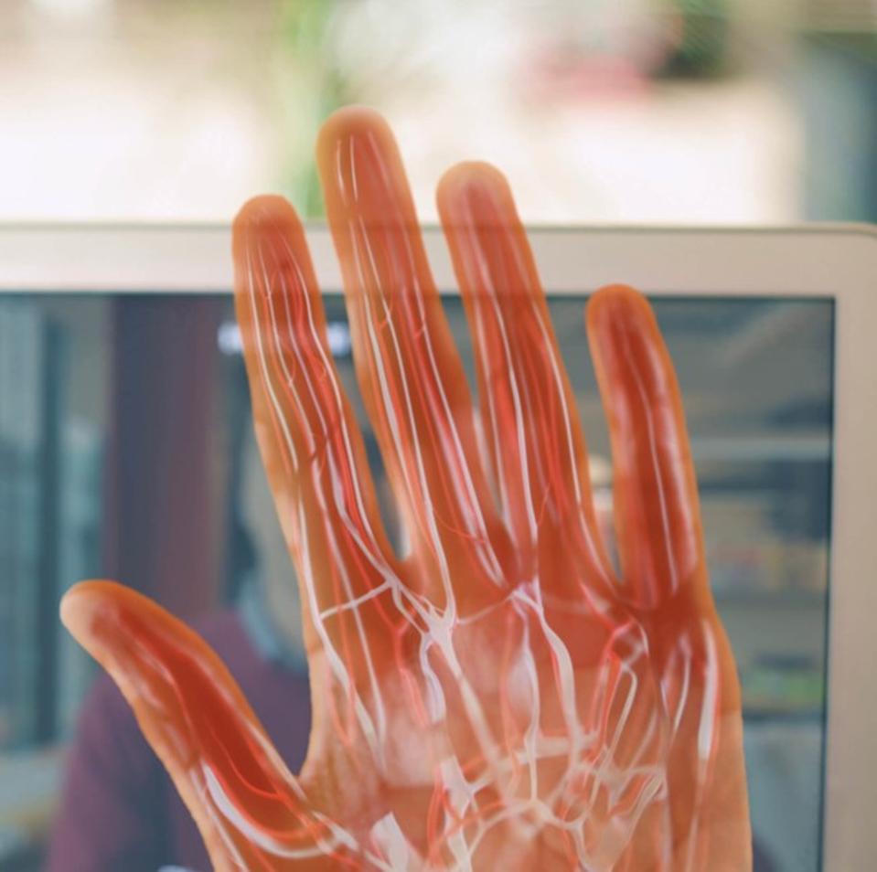 a picture showing vein patterns in a hand