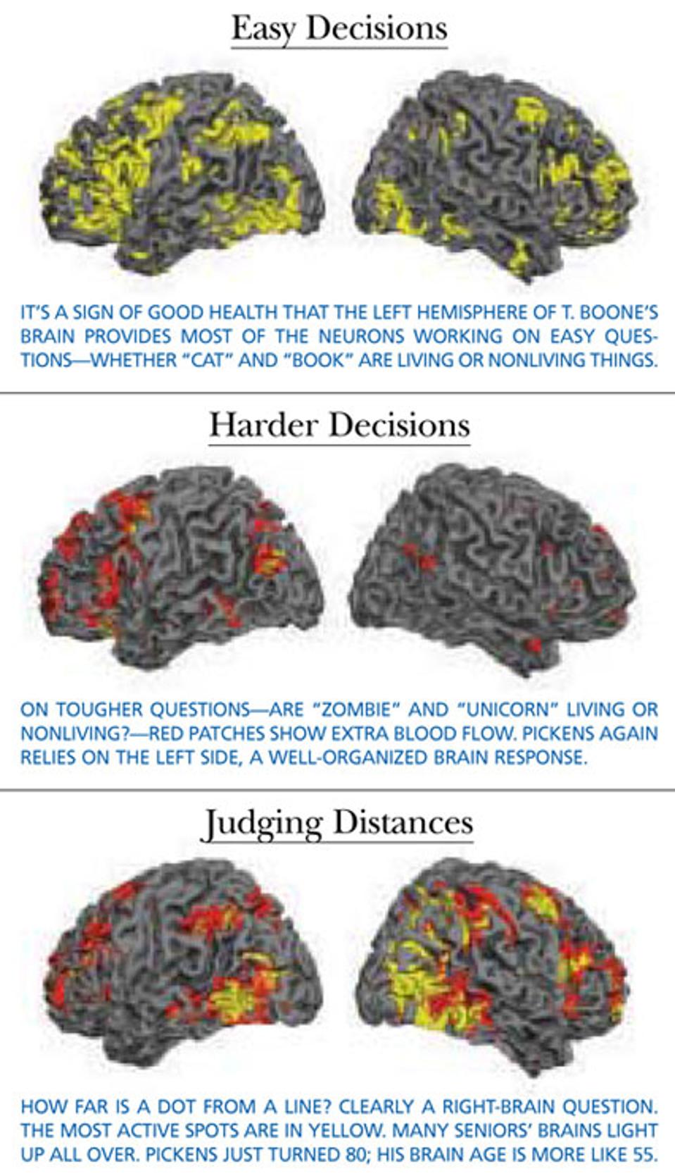 Pickens' brain.