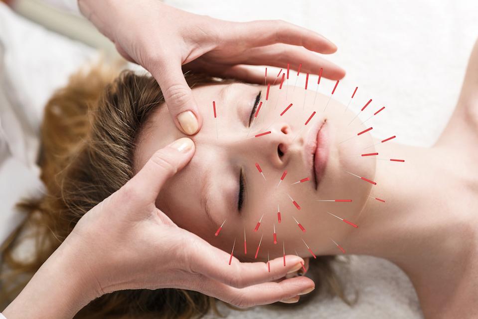 Cosmetic acupuncture by Dr. John Tsagaris