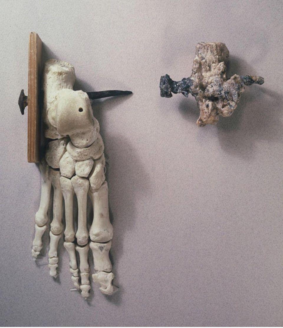 Right: The calcaneus of Yehohanon ben Hagkol, with transfixed nail. Left: A reconstruction of what the foot may have looked like around the time of death.