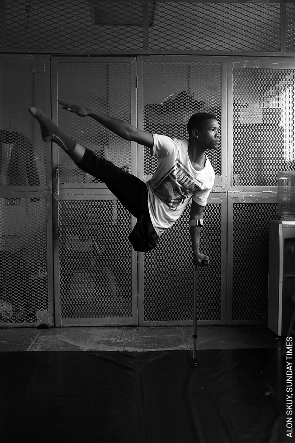 Vũ công chuyên nghiệp trên nạng