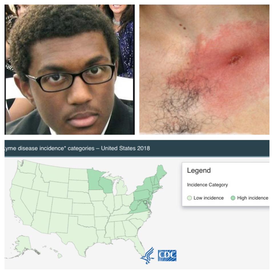 Lessons From Lyme Disease Six Reasons The Cdc S Covid 19 Failure Was Predictable