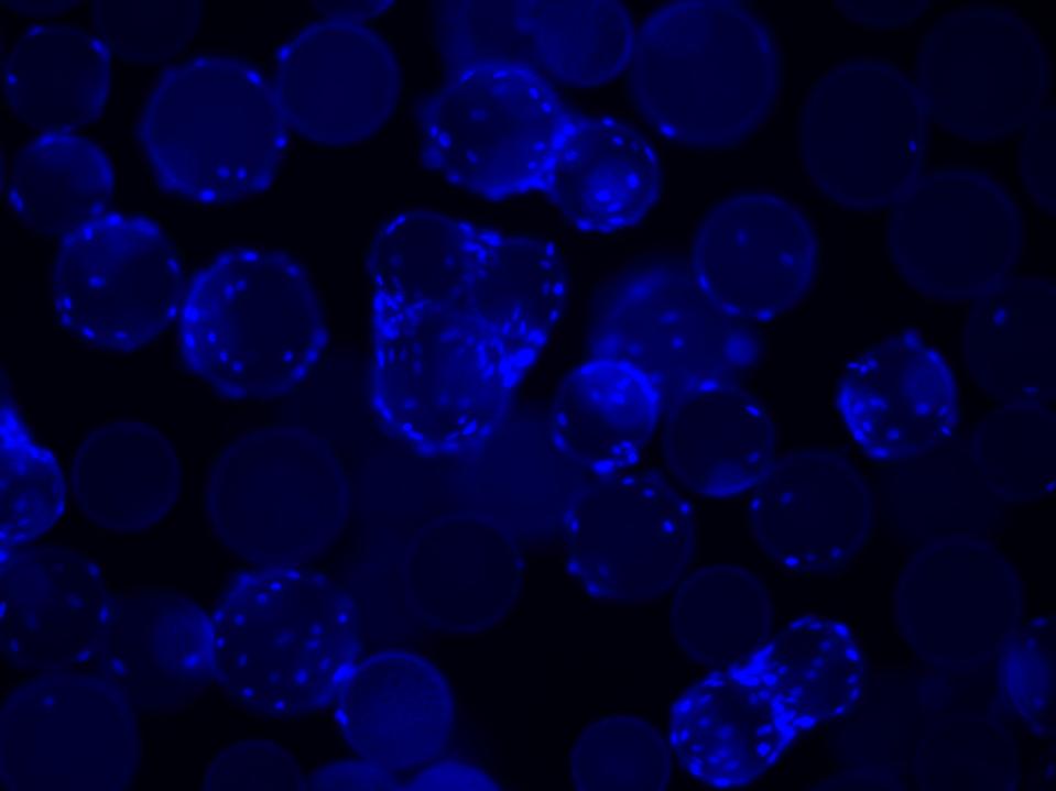 Clinical Trials Of Mesoblast S Stem Cell Treatment For Covid 19 Set To Begin Soon