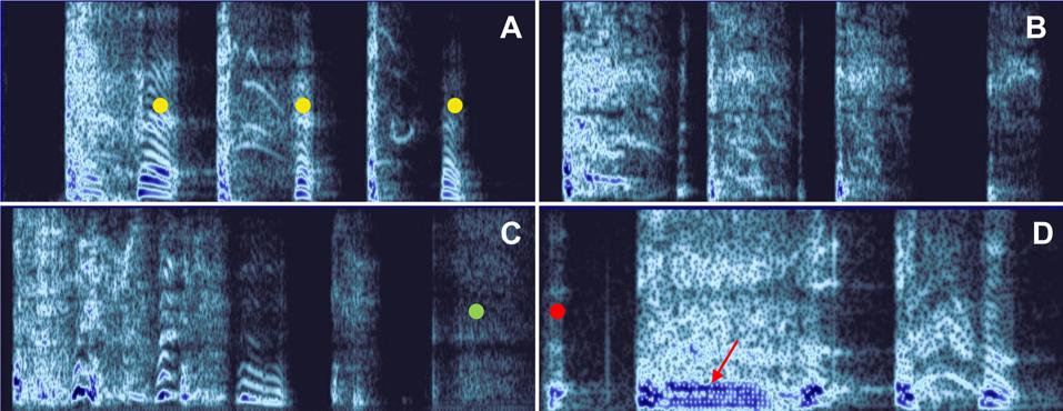 This is a spectrograph representation of different cough sequences.