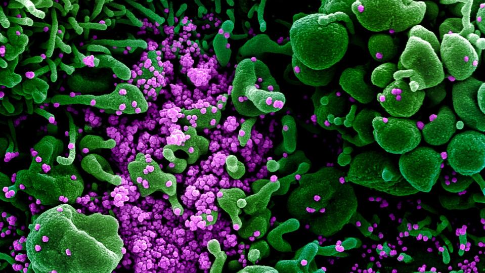 coronavirus