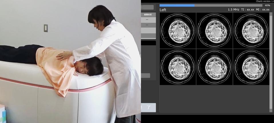 نظام الموجات فوق الصوتية ليلي ميدتيك