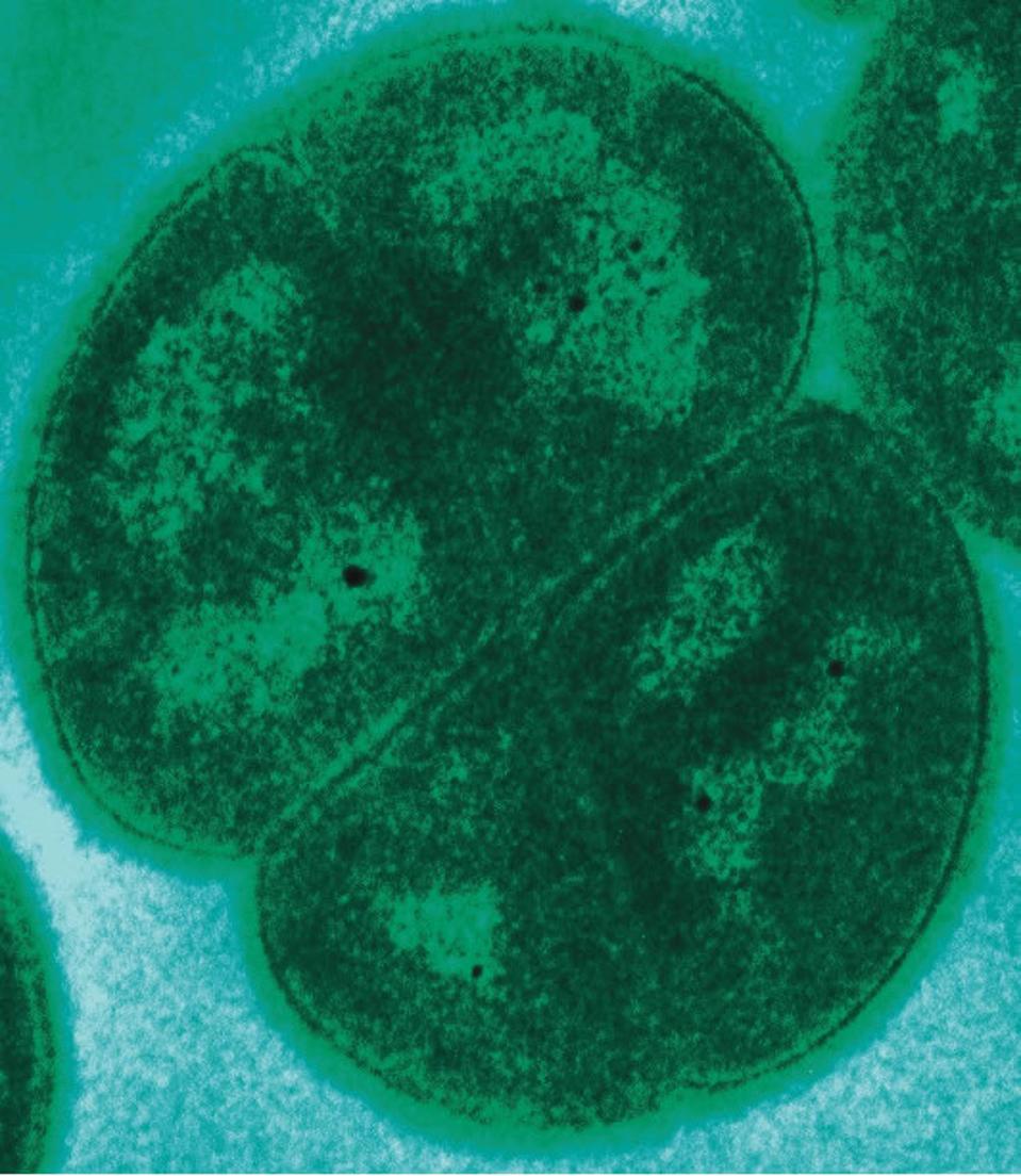 Deinococcus_radiodurans