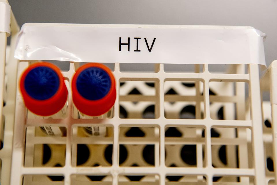 Test tubes that contains blood samples from patients that...