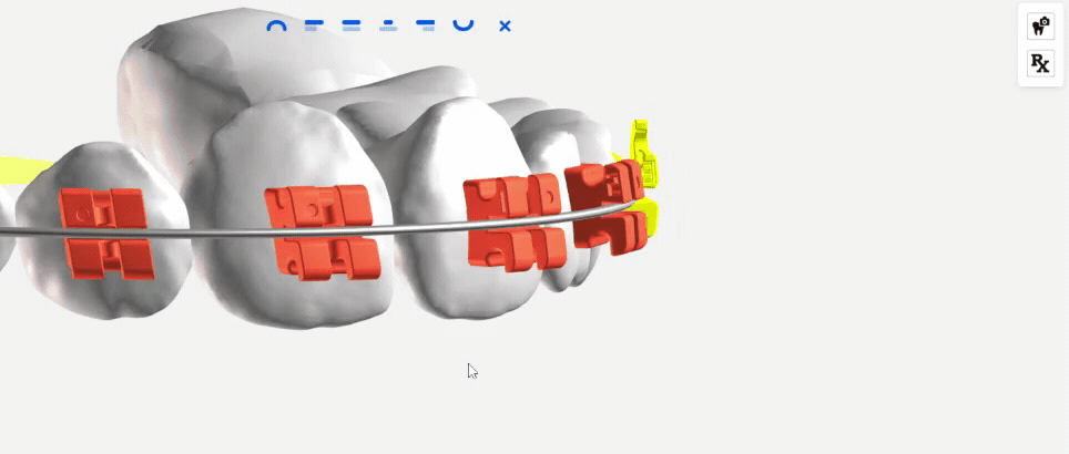 A gif animation shows fine-tuning of bracket planning.