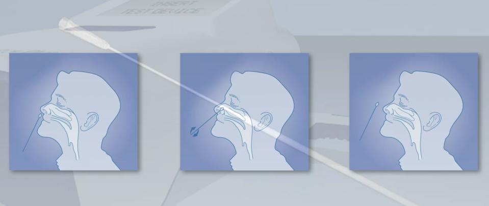 The BD antigen test uses swabs to capture material for testing.