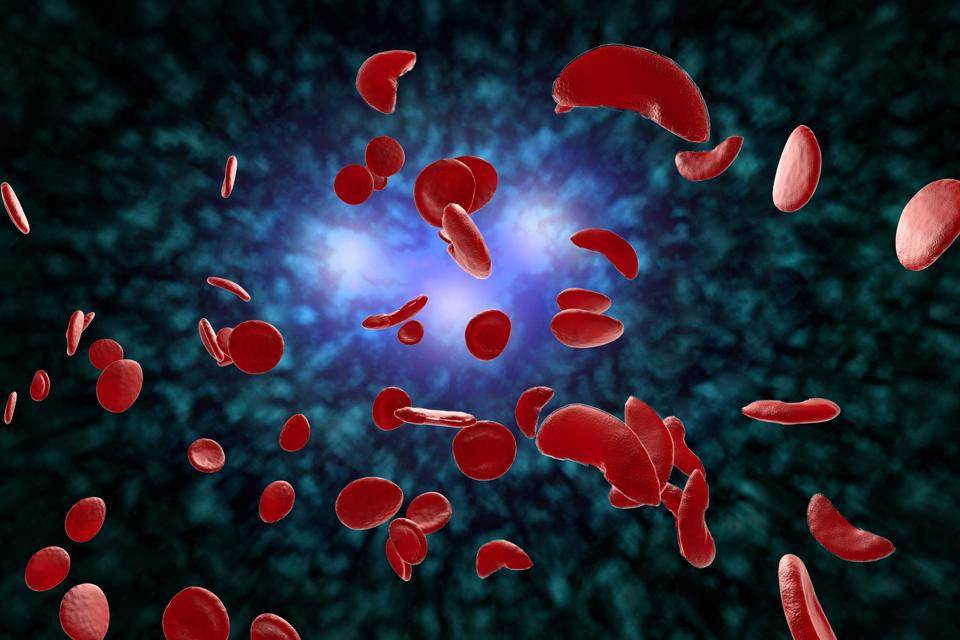 Illustration of red blood cells with sickle cell disease
