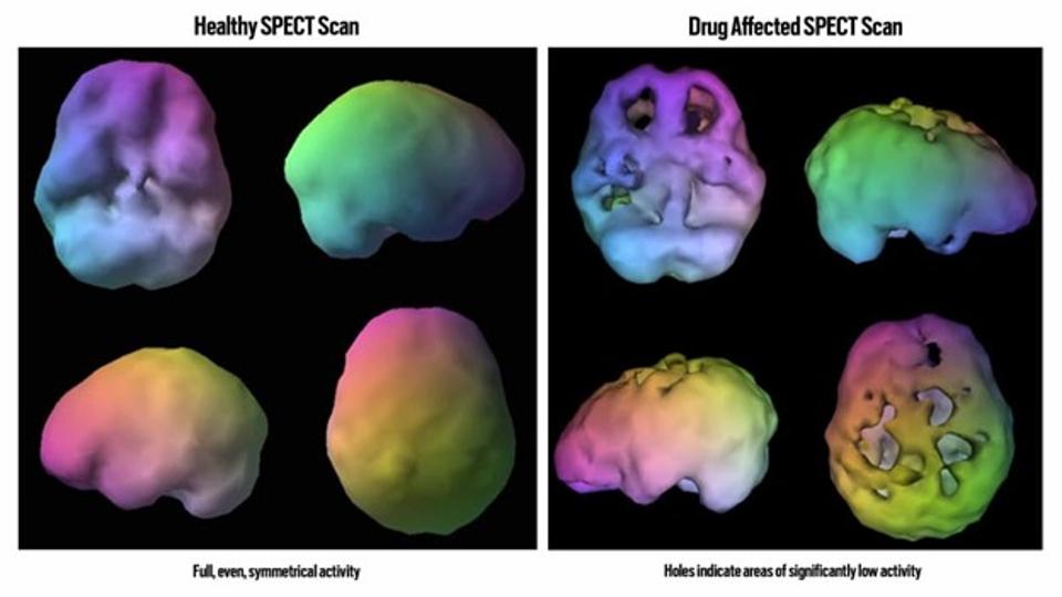 Don’t Make Your Brain Dumb: The Neuroscience Of Success