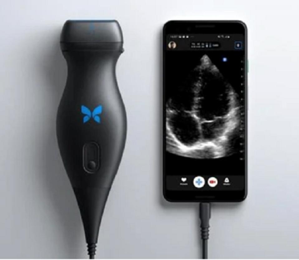 Source: Butterfly Network