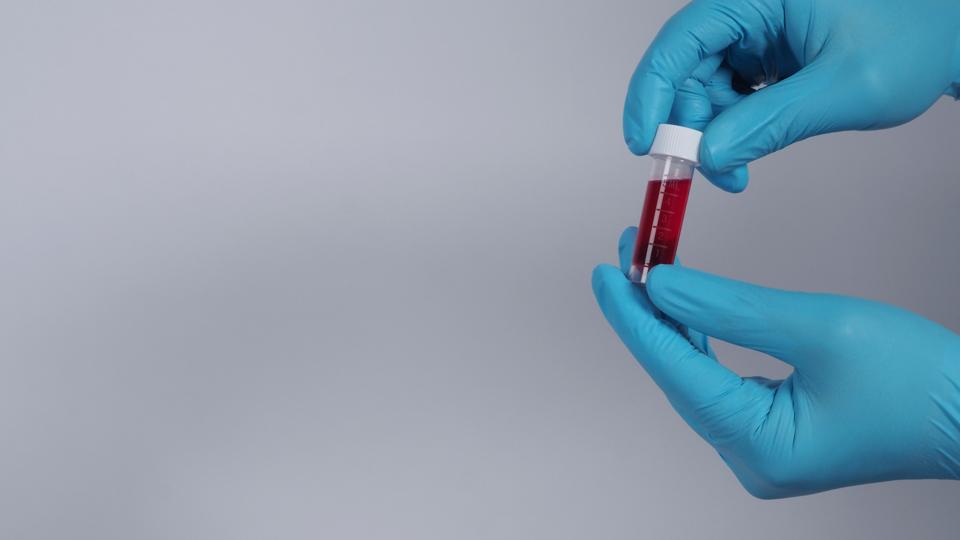 Australia Drops Promising Covid 19 Vaccine After Volunteers Falsely Tested Positive For Hiv Australia Drops Promising Covid 19 Vaccine After Volunteers Falsely Tested Positive For Hiv