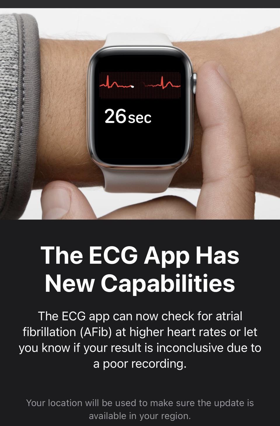 Look out for a notification of the ECG app upgrade.