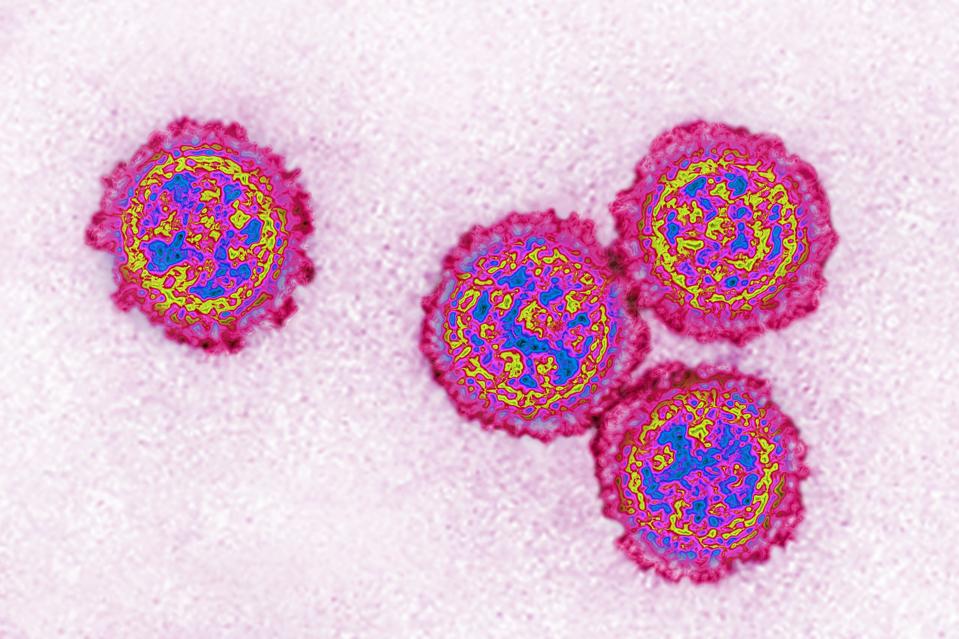 Influenza virus.