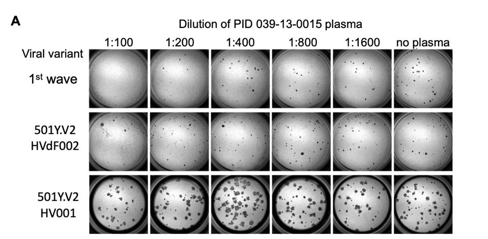 A representative focus forming assay using plasma from participant 039-13-0015.
