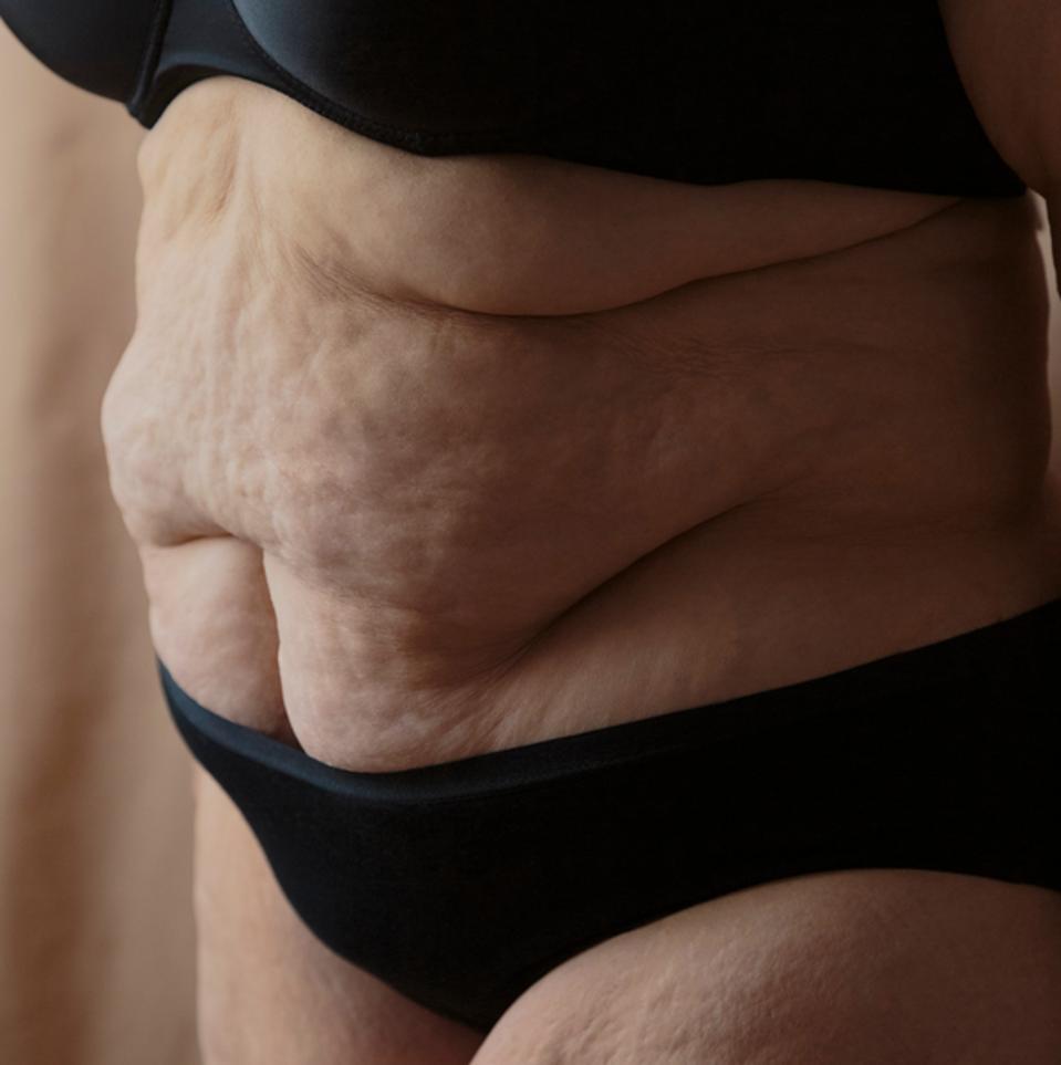 Crop Plus Size Woman With Cellulite Stomach