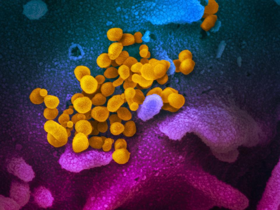 SARS-CoV-2 virus particles (yellow) emerging from cells (blue/pink).