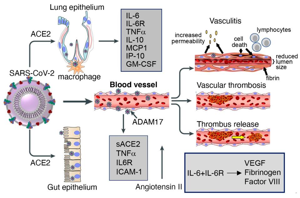 Lung and gut epithelia and vascular endothelia are infected by SARS-CoV-2.