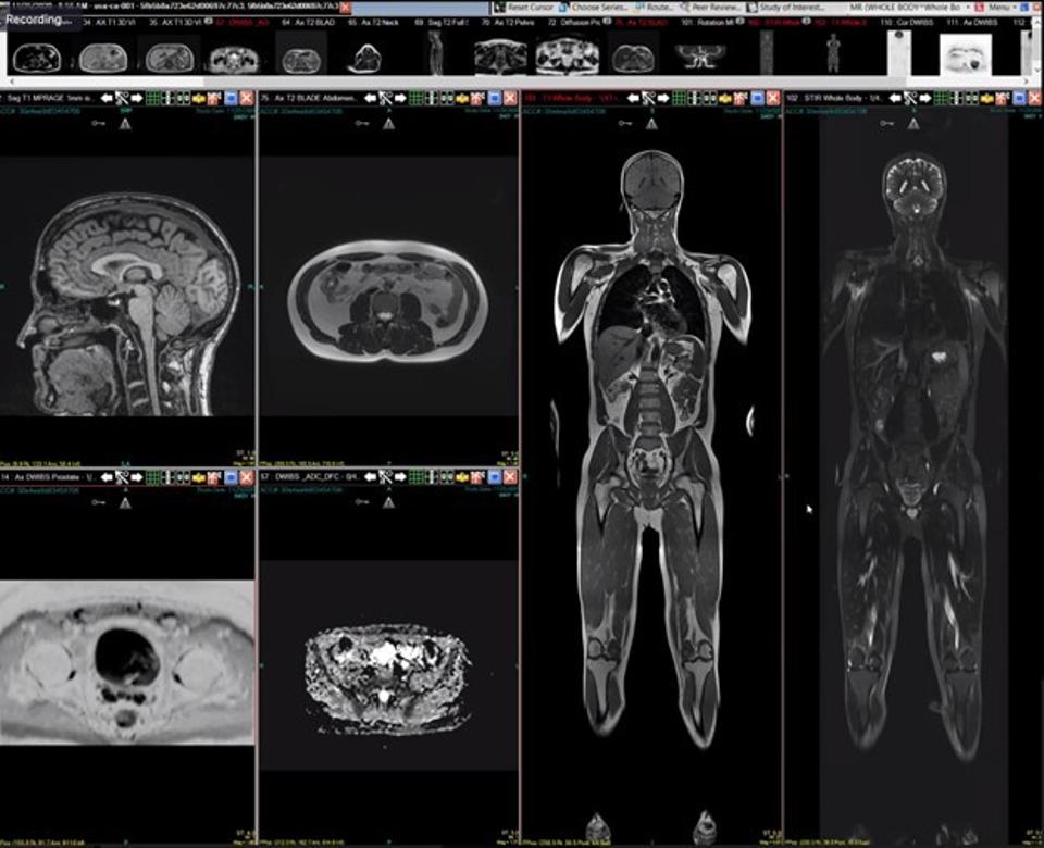 The Latest Quantified Self Trend Whole Body Mri The Latest Quantified Self Trend Whole Body Mri