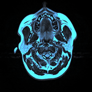 A gif of a brain MRI scan