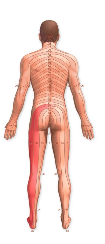 Illustration of dermatomes