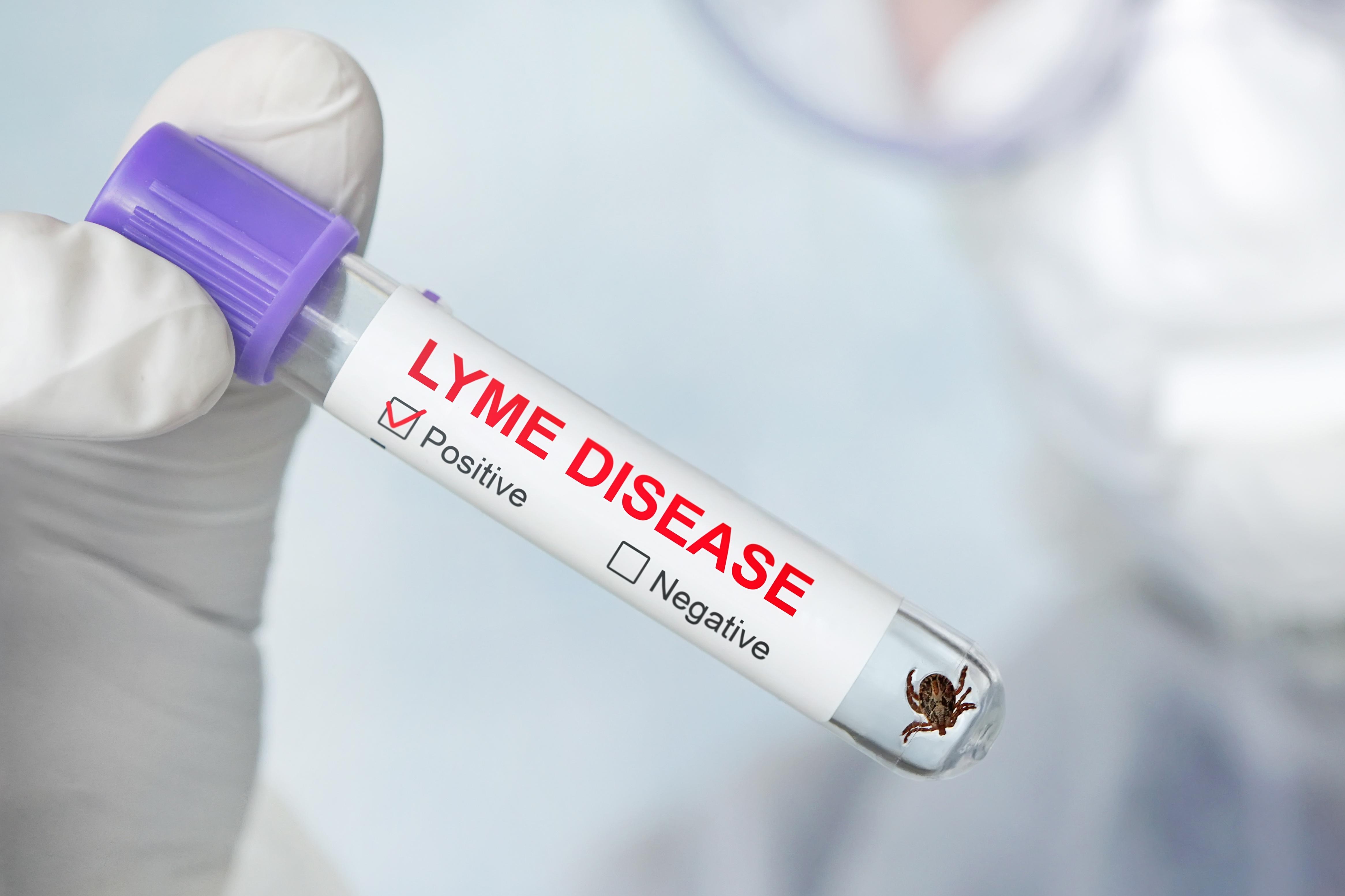 You Have No Vaccination-Lyme Disease Is Coming Back With A Vengeance - Vimarsana News