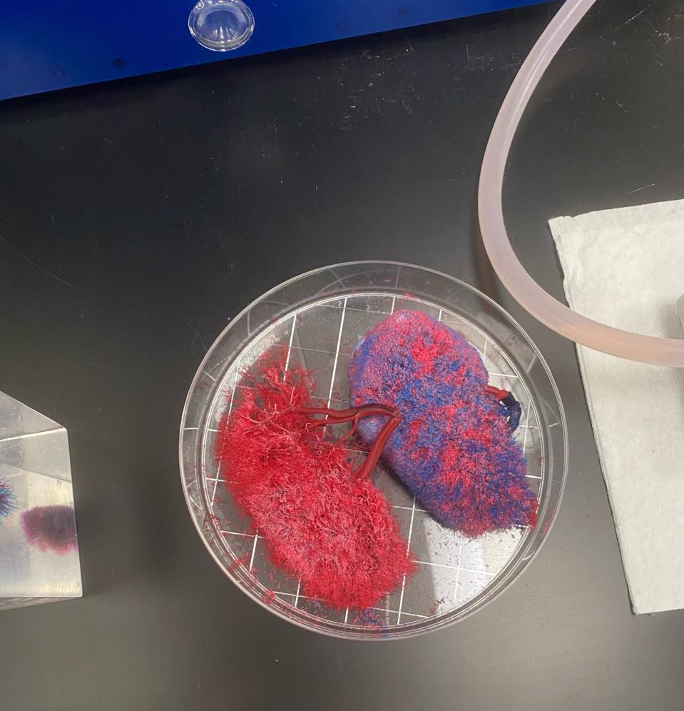 Kidney created by the Wake Forest Institute for Regenerative Medicine lead by Dr. Anthony Atala and his team of four-hundred employees.