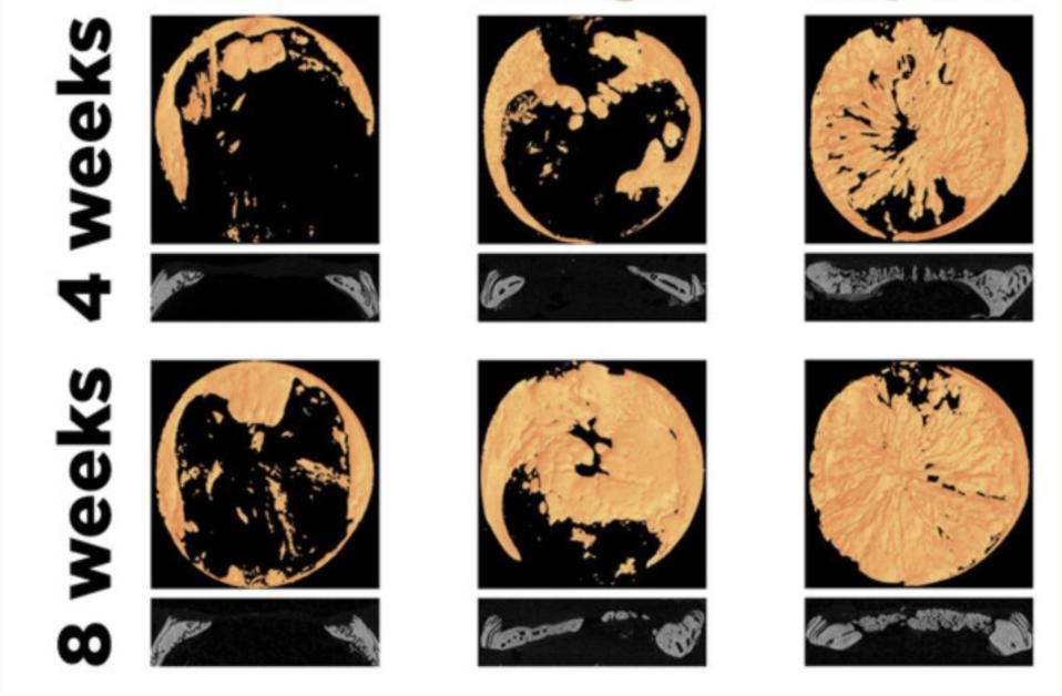 This figure is a CT scan of the front and back of the regenerated cranial bone four weeks and eight weeks after implantation of the 3-D model.
