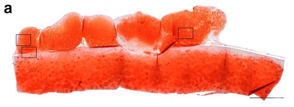 Human articular cartilage co-culture.