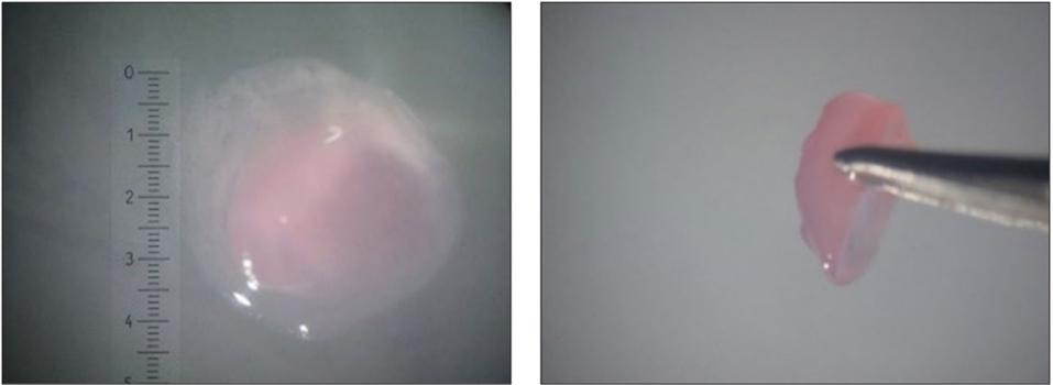 Polyethylene terephthalate-transwell membrane grown cartilage.