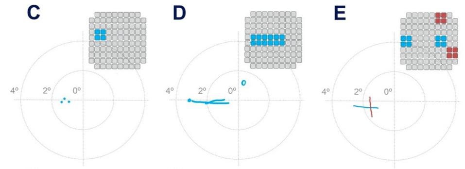 Pattern recognition test results.