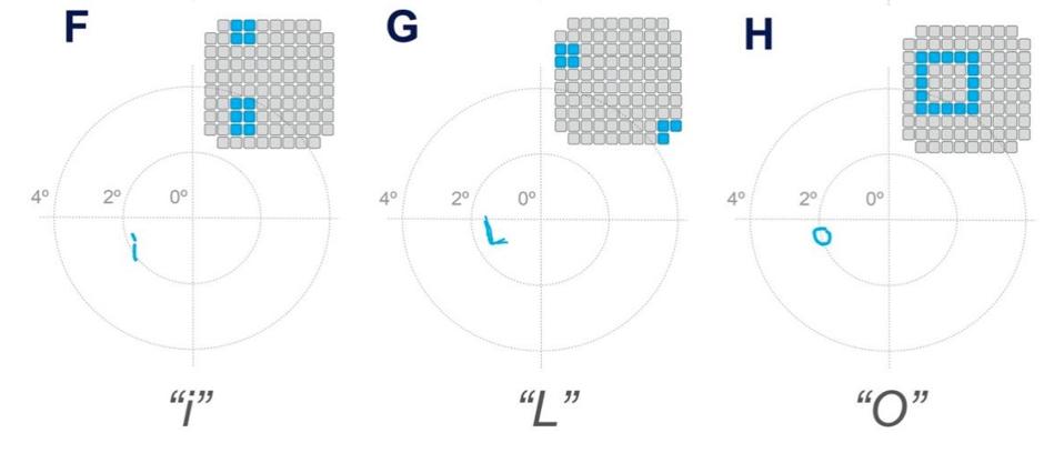 Letter recognition test results.