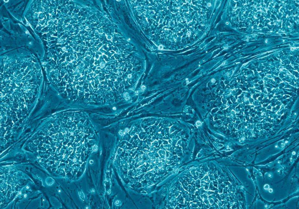 Human embryonic stem cells